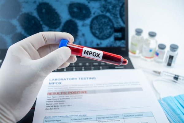 Gloved hand holding a blood specimen tube with MPOX label; background is lab testing form for MPOX, vaccine bottles, cells